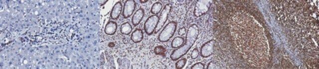 Anti-CREB Antibody, clone LB9, Ascites Free