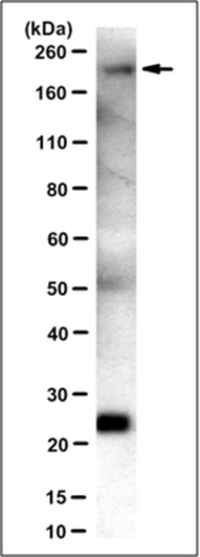 Anti-Laminin γ1 Antibody, clone 2E8 (Ascites Free)