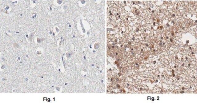 Anti-APP Antibody, CT, clone 2.F2.19B4, Ascites Free
