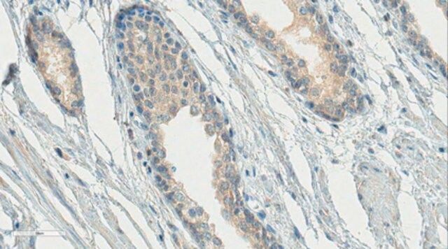 Anti-Gonadotropin-Releasing Hormone Antibody, NT, clone HU11B (Ascites Free)