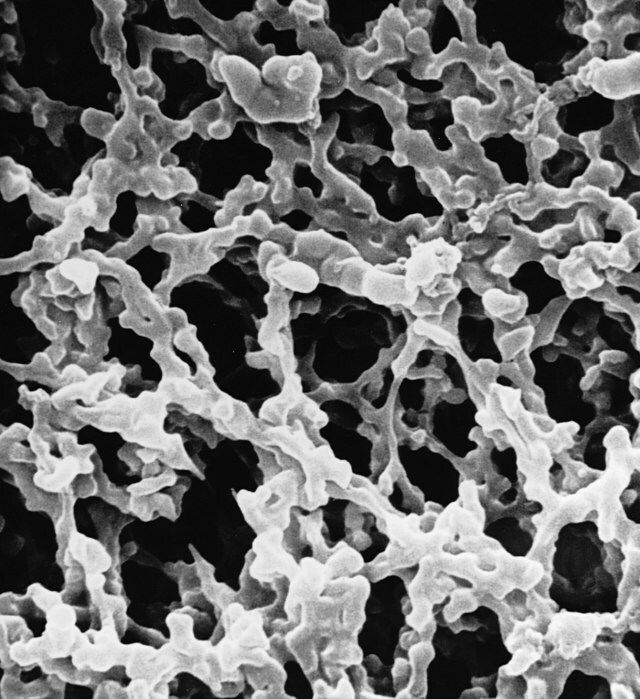 MF-Millipore<sup>®</sup> Membrane Filter, 0.45 μm pore size, gridded