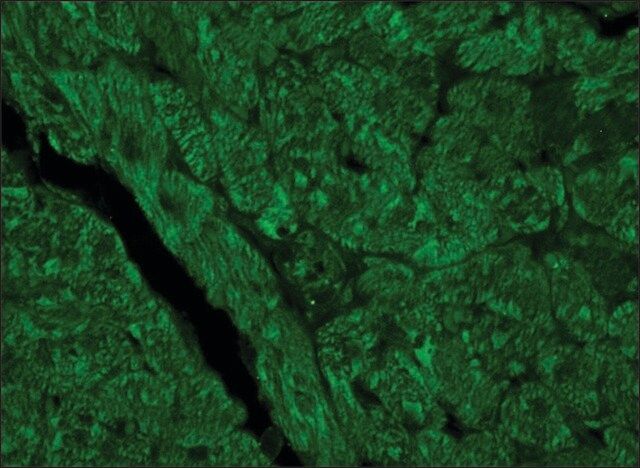 Anti-Vinculin antibody produced in rabbit