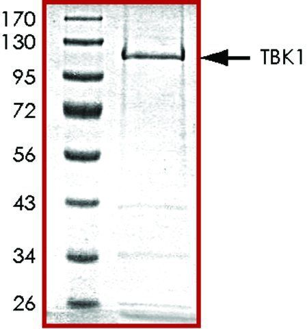TBK1, active, GST tagged human