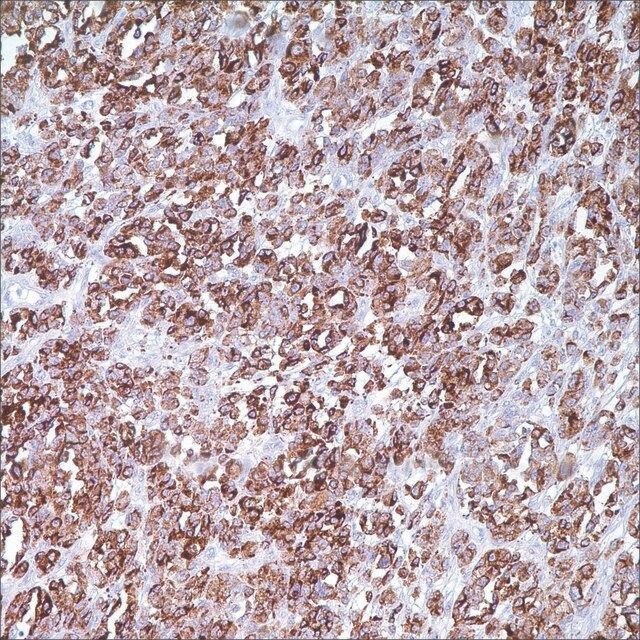 PNL2 (PNL2) Mouse Monoclonal Antibody