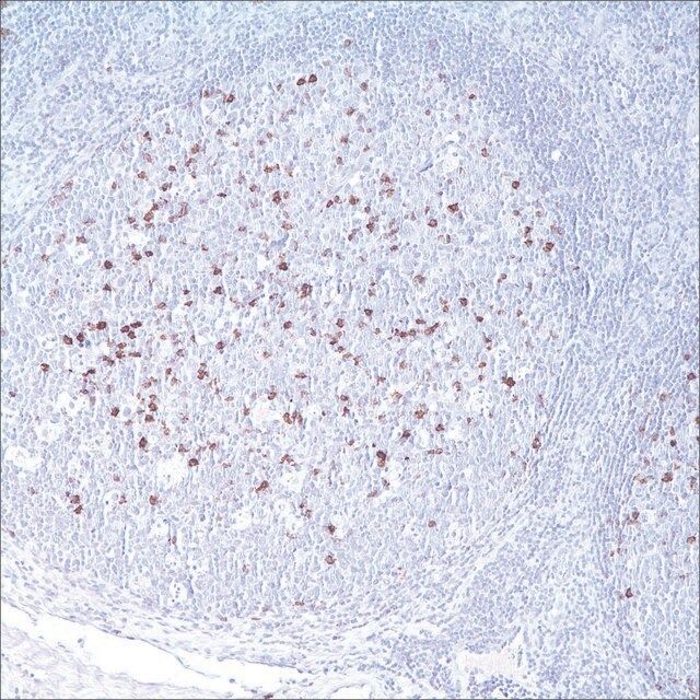 CD57 (NK-1) Mouse Monoclonal Antibody