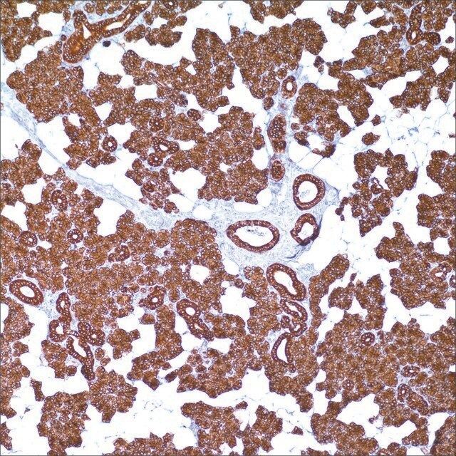Cytokeratin 8 &18 (B22.1 &B23.1) Mouse Monoclonal Antibody