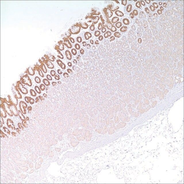 MUC5AC (MRQ-19) Mouse Monoclonal Antibody