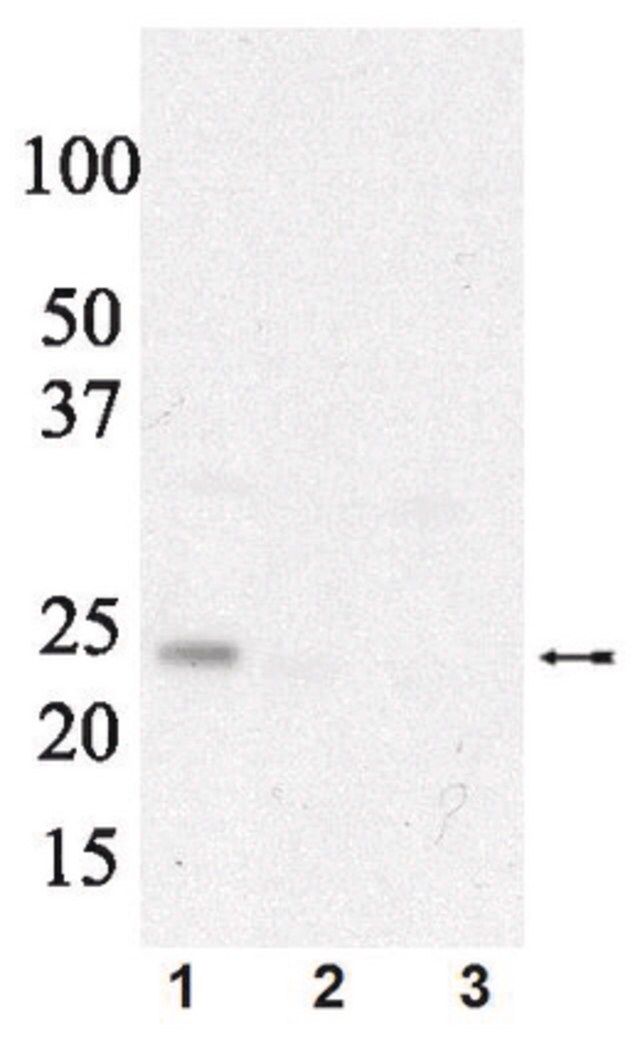 Anti-phospho eIF4E (Ser209) Antibody