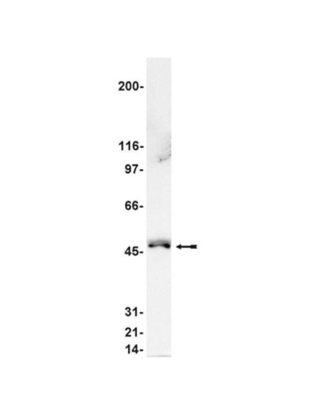 Anti-Nckβ Antibody
