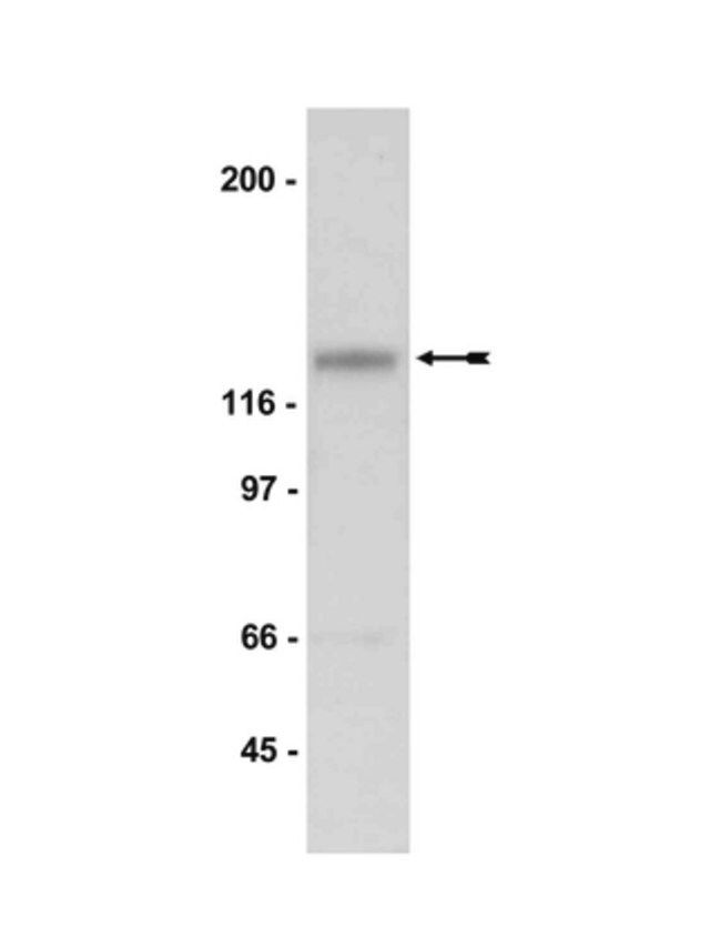 Anti-NR3A Antibody