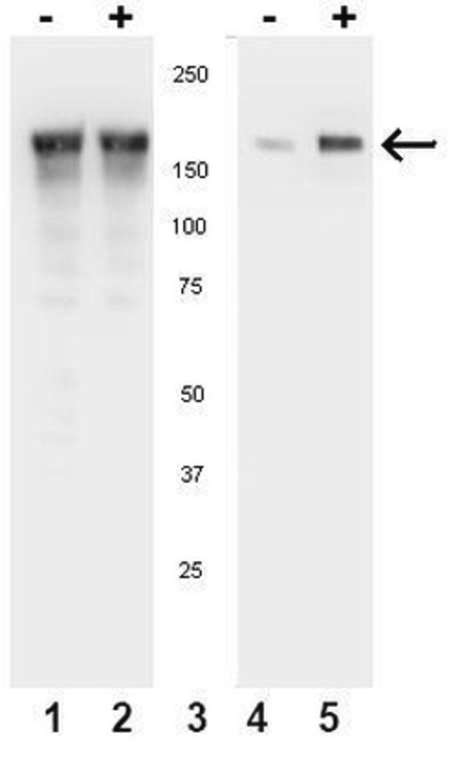 Anti-phospho-EGFR (Tyr1086) Antibody