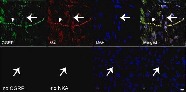 Anti-Na+K+ ATPase α-2 Antibody