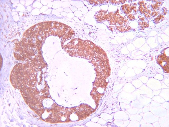 Anti-phospho-Akt (Thr308) Antibody