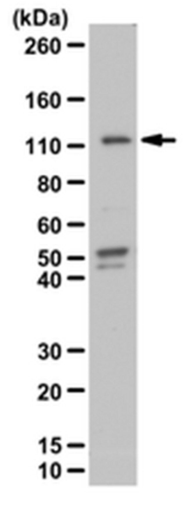 Anti-phospho-STAT2 (Tyr689) Antibody