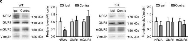 Anti-NR2A Antibody