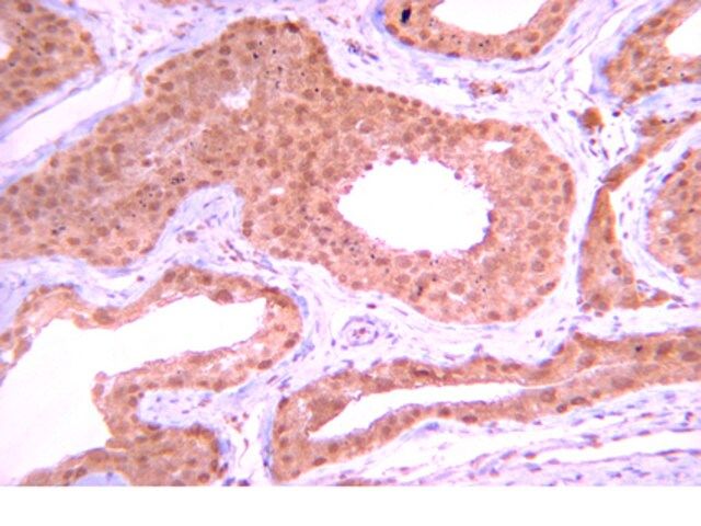 Anti-PP1β Antibody