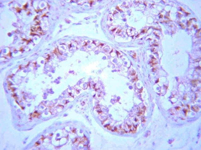 Anti-PP2A Antibody, B β subunit