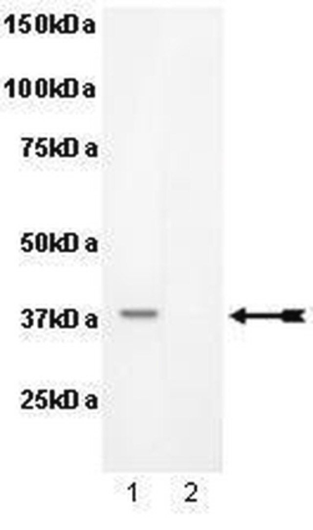 Anti-phospho-PKA Catalytic β subunit (Ser338) Antibody