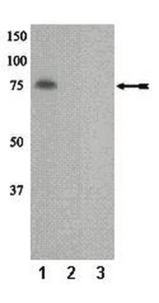 Anti-phospho-PKCη (Thr655) Antibody