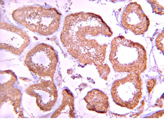 Anti-Protein Phosphatase 2 C α/β Antibody