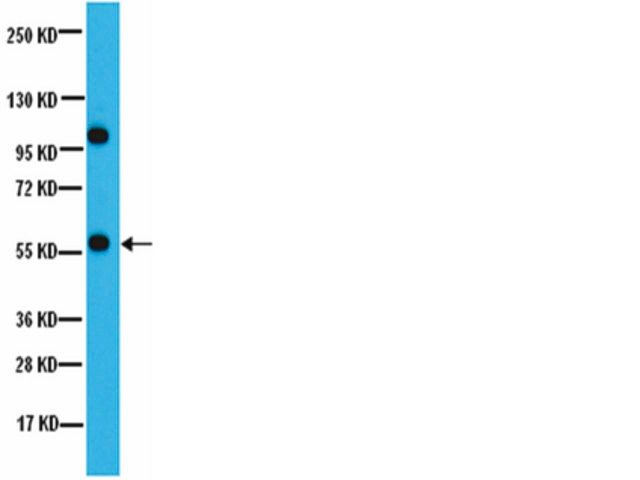 Anti-PP2A-B′ (B56) Antibody