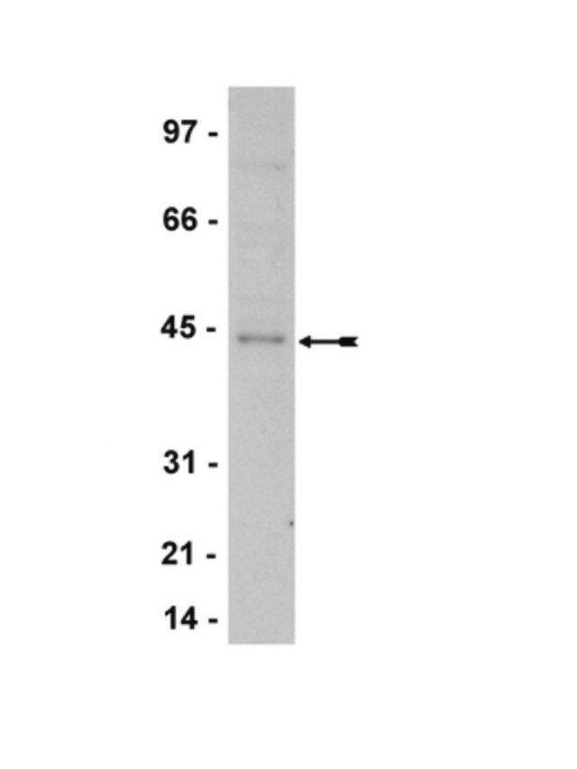 Anti-TTF-1 Antibody