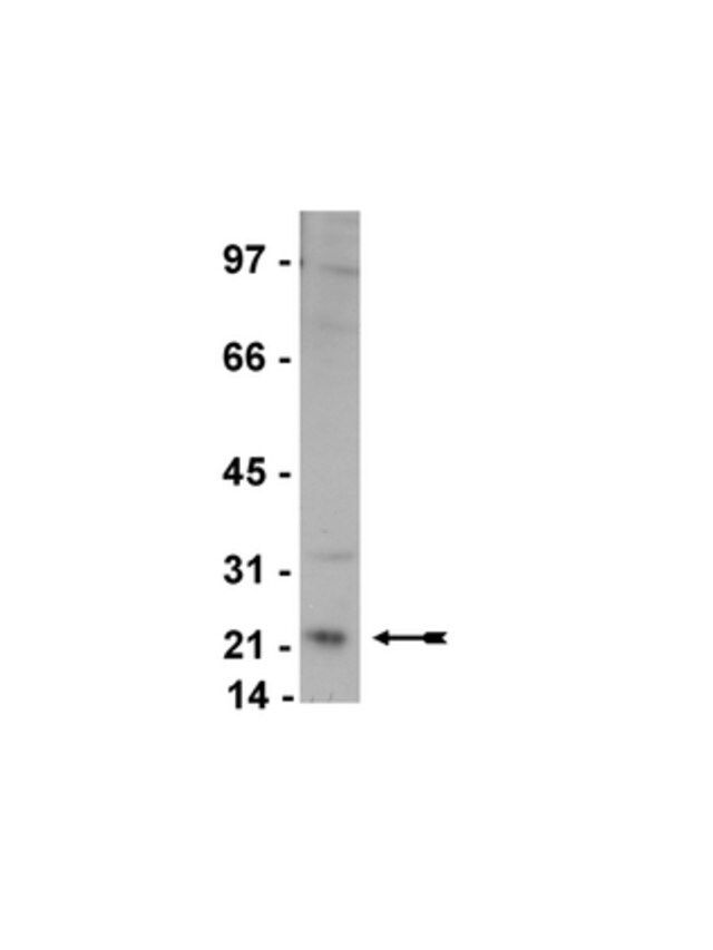 Anti-Rab4 Antibody