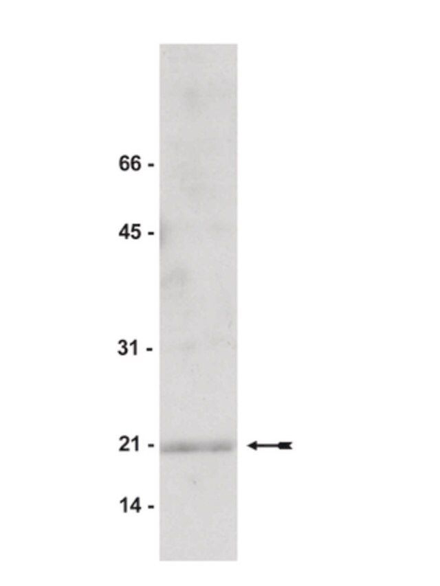 Anti-Cofilin 2 Antibody