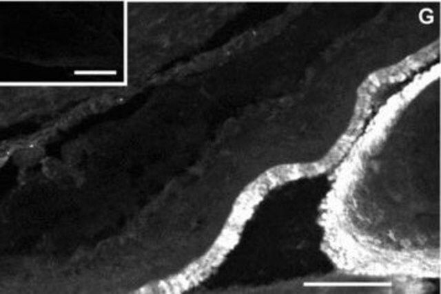 Monoclonal Anti-Cytokeratin Peptide 14 antibody produced in mouse