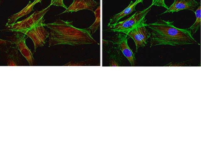 Anti-FOXO1 Antibody, clone 2H8.2