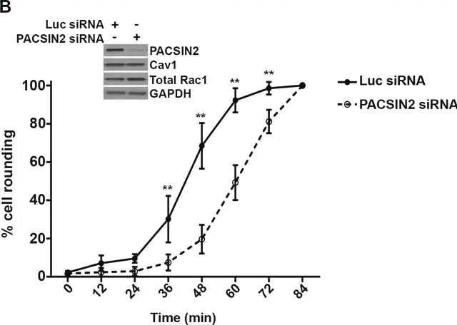 Anti-Rac1 Antibody, clone 23A8