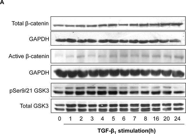 Anti-Active-β-Catenin (Anti-ABC) Antibody, clone 8E7