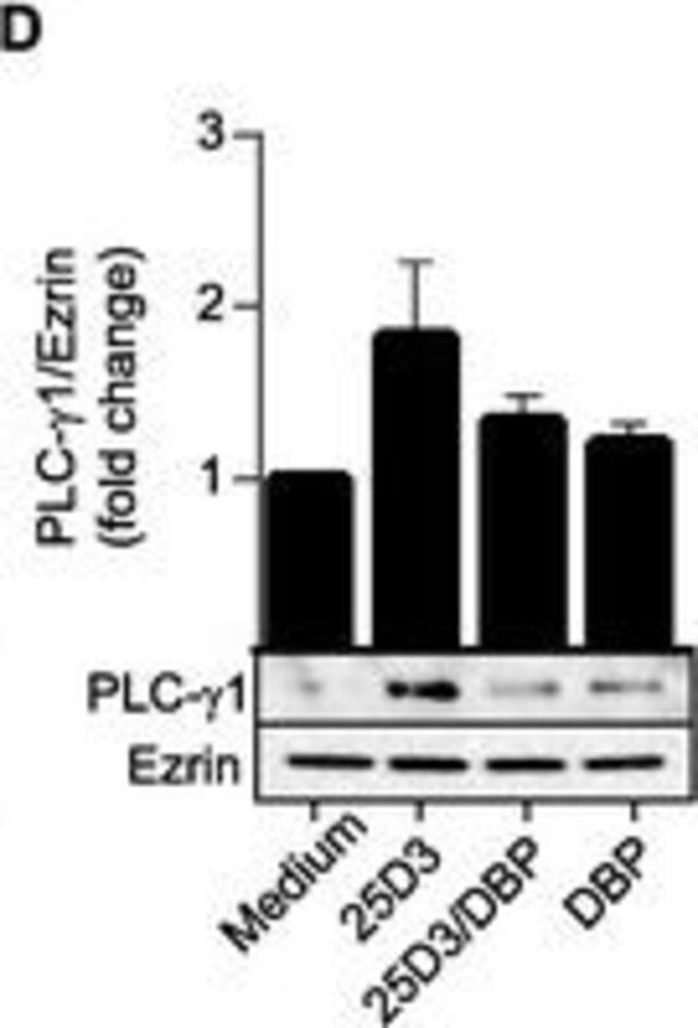 Anti-PLCγ-1 Antibody