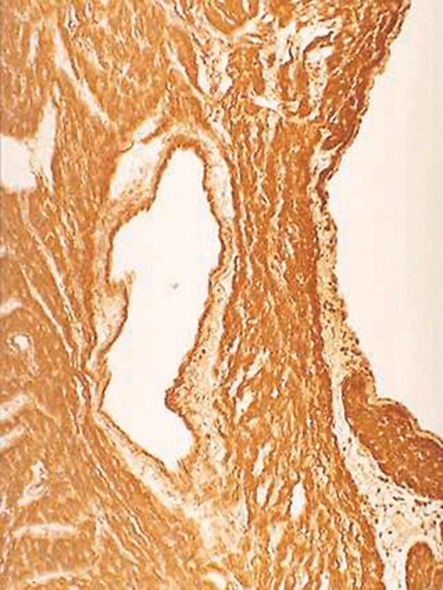 Anti-Nitrotyrosine Antibody, clone 1A6