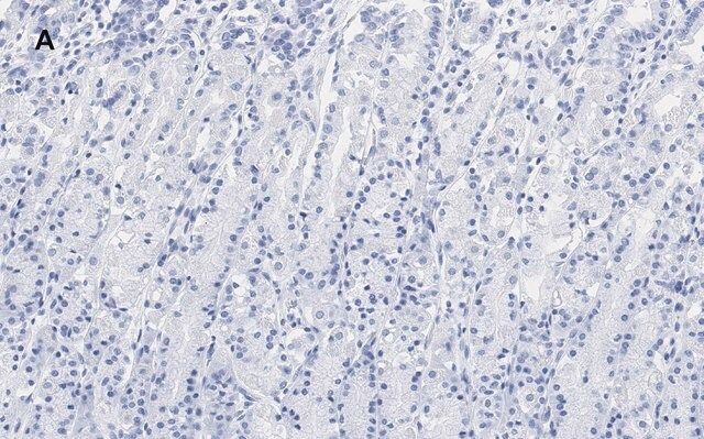 Anti-IKB α Antibody, clone 6O8, ZooMAb<sup>®</sup> Rabbit Monoclonal