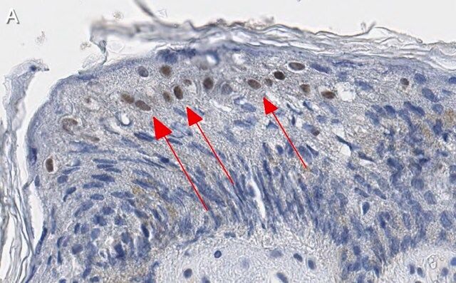 Anti-GRHL2 Antibody, clone 2N18 ZooMAb<sup>®</sup> Rabbit Monoclonal