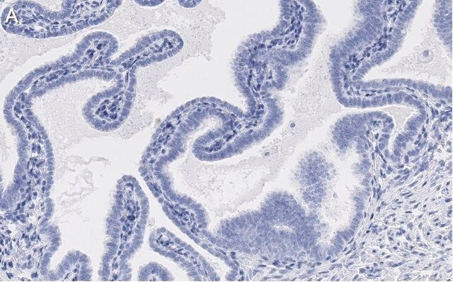 Anti-SOX17 Antibody, clone 3F7, ZooMAb<sup>®</sup> Rabbit Monoclonal