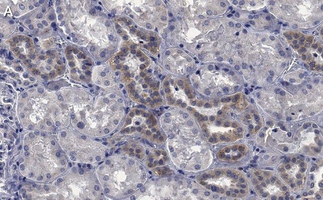 Anti-STX17 Antibody, clone 1B3 ZooMAb<sup>®</sup> Rabbit Monoclonal