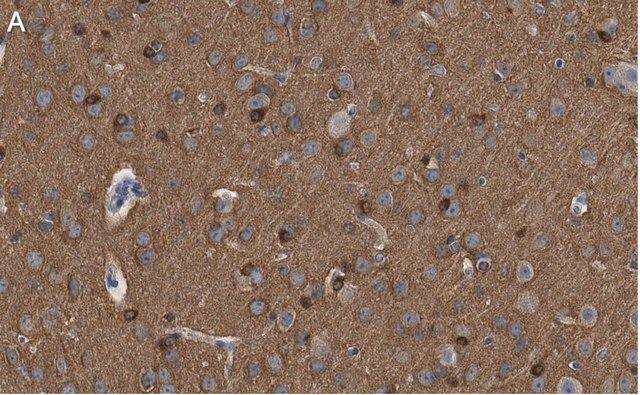 Anti-Tau-1 Antibody, clone PC1C6 ZooMAb<sup>®</sup> Mouse Monoclonal