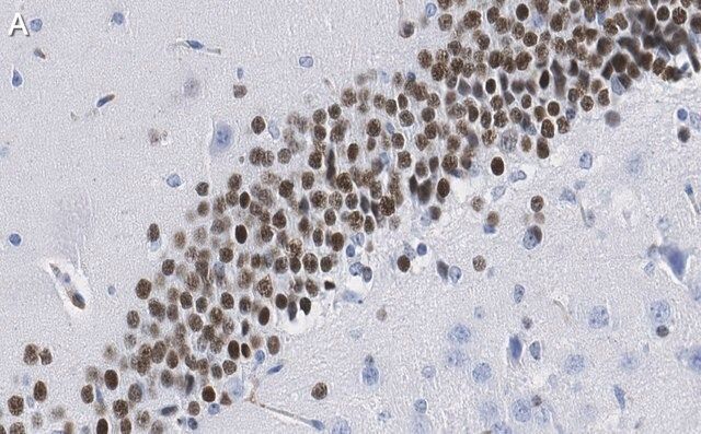Anti-PROX1 Antibody, clone 1B10 ZooMAb<sup>®</sup> Rabbit Monoclonal