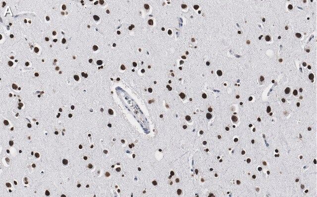 Anti-Histone H2A.X Antibody, clone 1C22 ZooMAb<sup>®</sup> Rabbit Monoclonal