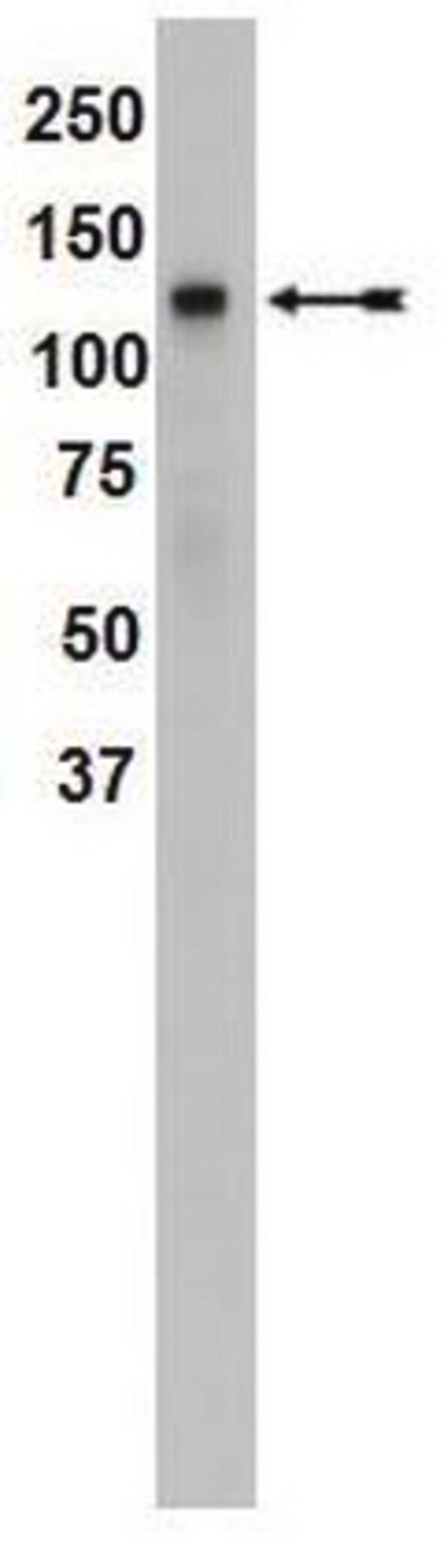 Anti-SREBP1 Antibody, clone 2121