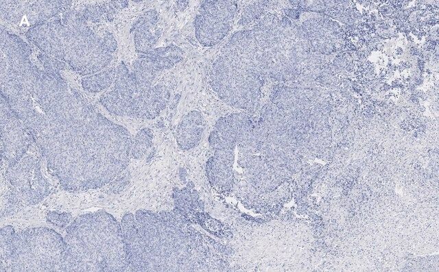 Anti-TAGLN Antibody, clone 1D10 , ZooMAb<sup>®</sup> Rabbit Monoclonal