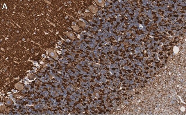 Anti-Synapsin-1 Antibody, clone 1G5 ZooMAb<sup>®</sup> Rabbit Monoclonal