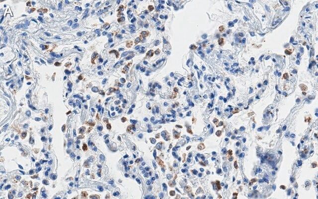 Anti-SFTPC Antibody, clone 3F18 ZooMAb<sup>®</sup> Rabbit Monoclonal