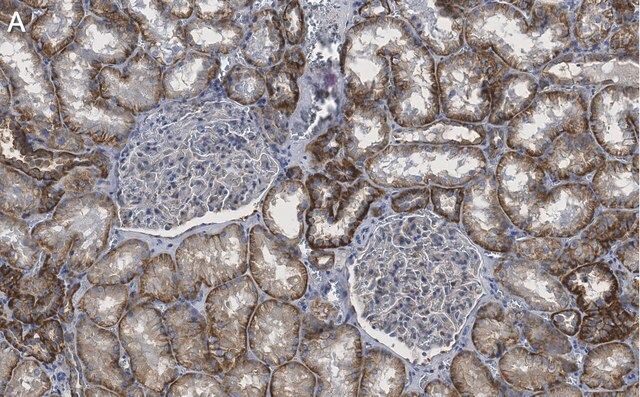 Anti-Spectrin α Antibody, clone 2G17 ZooMAb<sup>®</sup> Rabbit Monoclonal