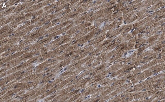 Anti-G0S2 Antibody, clone 2C13 ZooMAb<sup>®</sup> Rabbit Monoclonal