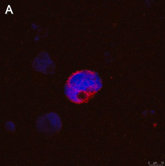 Anti-IFNγ Antibody, clone 5K15 ZooMAb<sup>®</sup> Rabbit Monoclonal