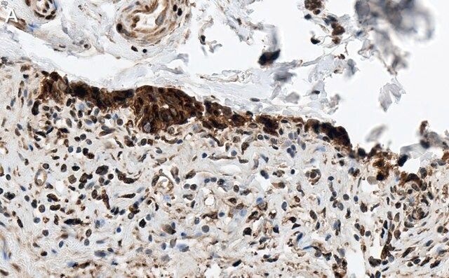 Anti-HSP70 Antibody, clone 4E12 ZooMAb<sup>®</sup> Rabbit Monoclonal