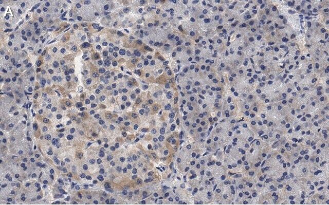 Anti-Helicase MOV-10 Antibody, clone 3B8 ZooMAb<sup>®</sup> Rabbit Monoclonal